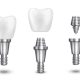 Implants dentals a Manresa